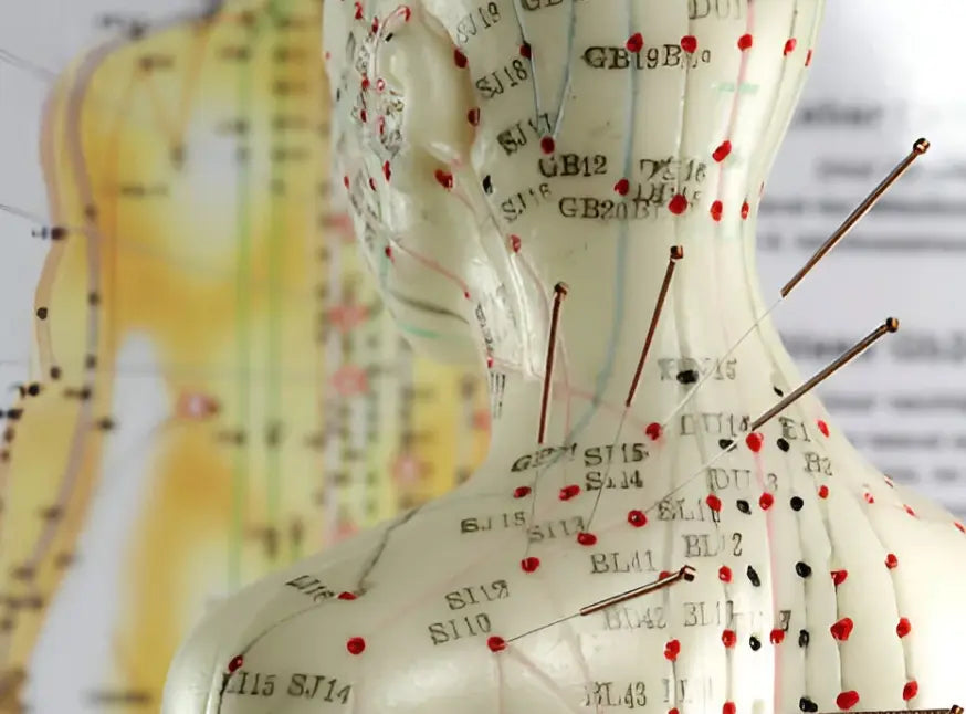 Acupuncture for Pain Management: Joints, Tendons & Natural Support Dr Julian Cano LLC